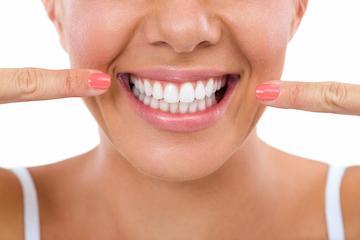 woman pointing to smile | Cosmetic Dentistry in Poway CA | AllDent Dental Center