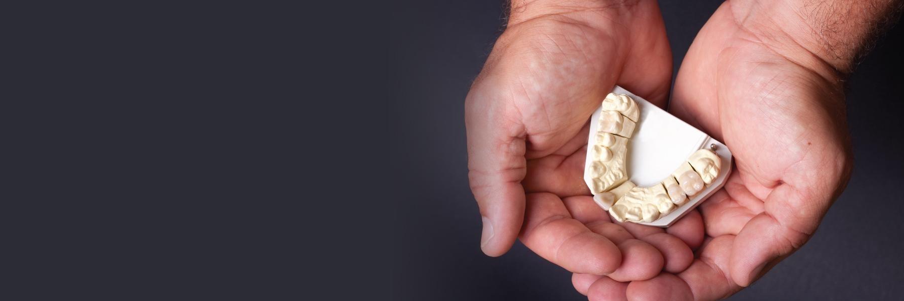 Hands holding model of teeth | Replace missing teeth in Poway CA